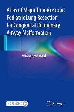 Atlas of Major Thoracoscopic Pediatric Lung Resection for Congenital Pulmonary Airway Malformation - Bonnard, Arnaud