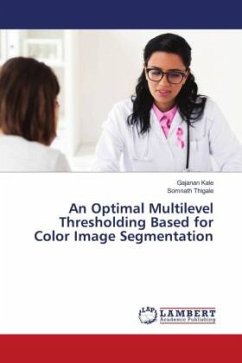 An Optimal Multilevel Thresholding Based for Color Image Segmentation