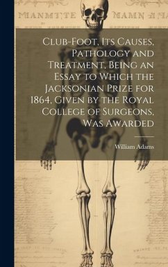 Club-foot, its Causes, Pathology and Treatment, Being an Essay to Which the Jacksonian Prize for 1864, Given by the Royal College of Surgeons, was Awa - Adams, William