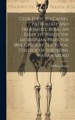 Club-foot, its Causes, Pathology and Treatment, Being an Essay to Which the Jacksonian Prize for 1864, Given by the Royal College of Surgeons, was Awa - Adams, William