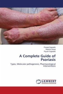 A Complete Guide of Psoriasis