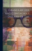 Granular Lids And Contagious Diseases Of The Eye