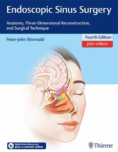 Endoscopic Sinus Surgery (eBook, ePUB) - Wormald, Peter J.
