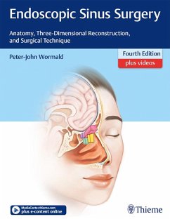 Cover Endoscopic Sinus Surgery (eBook, ePUB)