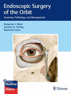 Endoscopic Surgery of the Orbit (eBook, ePUB) - Bleier, Benjamin S.; Freitag, Suzanne K.; Sacks, Raymond