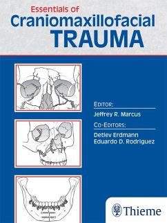 Essentials of Craniomaxillofacial Trauma (eBook, ePUB)