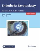 Endothelial Keratoplasty (eBook, ePUB) Endothelial Keratoplasty (eBook, ePUB)
