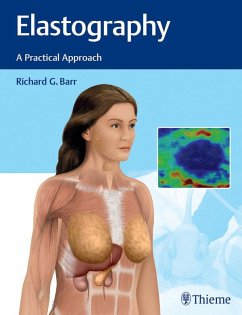 Elastography (eBook, ePUB) - Barr, Richard G.