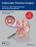 Endoscopic Pituitary Surgery (eBook, ePUB)