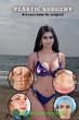 Plastic surgery - Bild 1