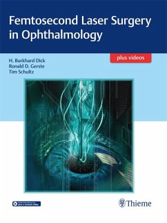 Femtosecond Laser Surgery in Ophthalmology (eBook, ePUB) - Dick, Burkhard; Gerste, Ronald D.; Schultz, Tim