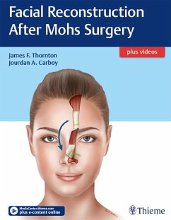 Facial Reconstruction After Mohs Surgery (eBook, ePUB)