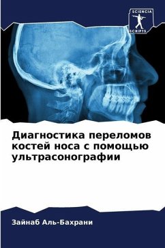 Diagnostika perelomow kostej nosa s pomosch'ü ul'trasonografii - Al'-Bahrani, Zajnab