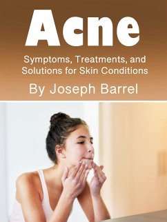 Acne (eBook, ePUB) - Barrel, Joseph