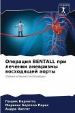 Operaciq BENTALL pri lechenii anewrizmy woshodqschej aorty