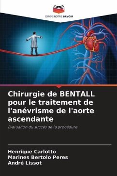 Chirurgie de BENTALL pour le traitement de l'anévrisme de l'aorte ascendante - Carlotto, Henrique;Bertolo Peres, Marines;Lissot, André
