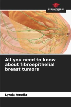 All you need to know about fibroepithelial breast tumors - Aoudia, Lynda