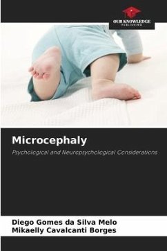 Microcephaly - Gomes da Silva Melo, Diego;Borges, Mikaelly Cavalcanti