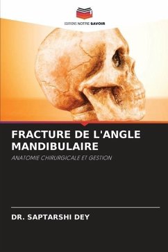 FRACTURE DE L'ANGLE MANDIBULAIRE - DEY, DR. SAPTARSHI