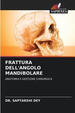 FRATTURA DELL'ANGOLO MANDIBOLARE - DEY, DR. SAPTARSHI