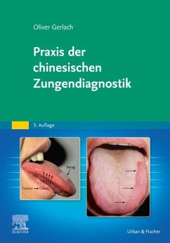 Praxis der chinesischen Zungendiagnostik - Gerlach, Oliver