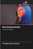 Dermatomiosite