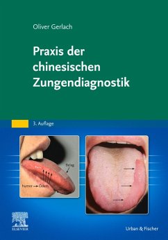 Praxis der chinesischen Zungendiagnostik (eBook, ePUB) - Gerlach, Oliver