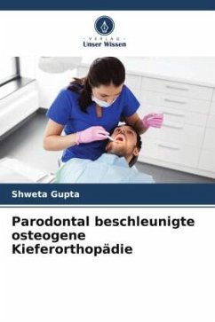 Parodontal beschleunigte osteogene Kieferorthopädie - Gupta, Shweta