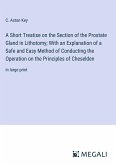 A Short Treatise on the Section of the Prostate Gland in Lithotomy; With an Explanation of a Safe and Easy Method of Conducting the Operation on the Principles of Cheselden