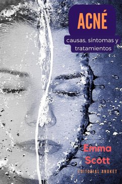 Cover Acné: Causas, Síntomas y Tratamientos (eBook, ePUB)