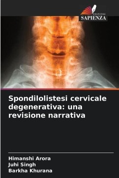 Spondilolistesi cervicale degenerativa: una revisione narrativa - Arora, Himanshi;Singh, Juhi;Khurana, Barkha