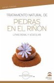 Tratamiento natural de piedras en el riñón: Litiasis renal y vesicular