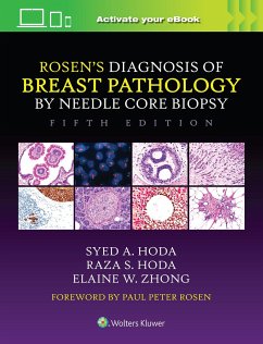 Rosen's Diagnosis of Breast Pathology by Needle Core Biopsy - Hoda, Syed A.; Hoda, Raza S.; Zhong, Elaine