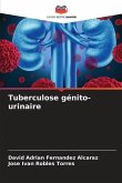 Tuberculose génito-urinaire