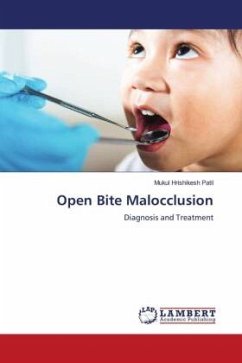 Open Bite Malocclusion - Patil, Mukul Hrishikesh