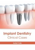 Implant Dentistry: Clinical Cases
