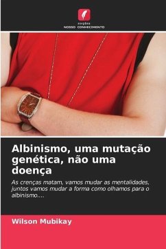 Albinismo, uma mutação genética, não uma doença - MUBIKAY, Wilson