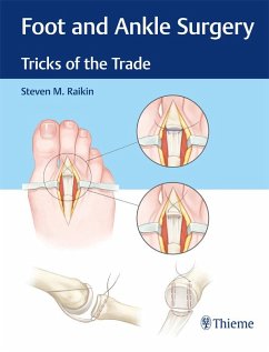 Foot and Ankle Surgery (eBook, ePUB) - Raikin, Steven M.