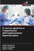Il cancro gastrico e l'importanza dell'esplorazione laparoscopica