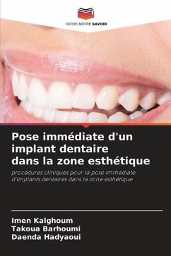 Pose immédiate d'un implant dentaire dans la zone esthétique - Kalghoum, Imen;Barhoumi, Takoua;Hadyaoui, Daenda