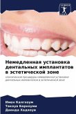 Nemedlennaq ustanowka dental'nyh implantatow w ästeticheskoj zone