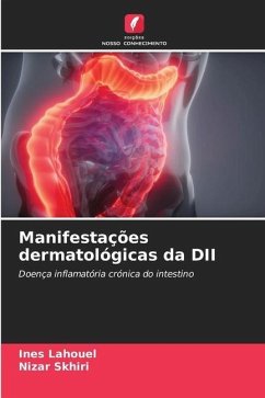 Manifestações dermatológicas da DII - Lahouel, Ines;Skhiri, Nizar