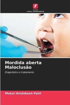 Mordida aberta Maloclusão - Patil, Mukul Hrishikesh