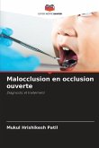 Malocclusion en occlusion ouverte