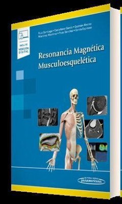 Resonancia Magnética Musculoesquelética