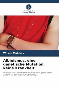 Albinismus, eine genetische Mutation, keine Krankheit - MUBIKAY, Wilson