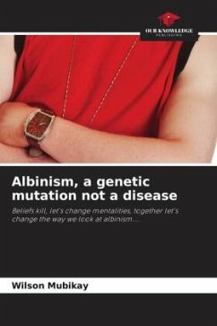 Albinism, a genetic mutation not a disease - MUBIKAY, Wilson