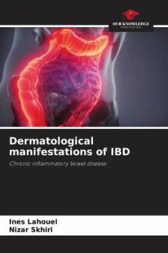 Dermatological manifestations of IBD - Lahouel, Ines;Skhiri, Nizar