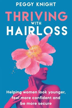 Thriving With Hairloss - Knight, Peggy