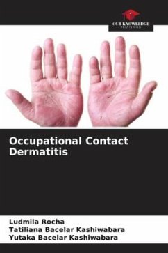 Occupational Contact Dermatitis - Rocha, Ludmila;Bacelar Kashiwabara, Tatiliana;Kashiwabara, Yutaka Bacelar